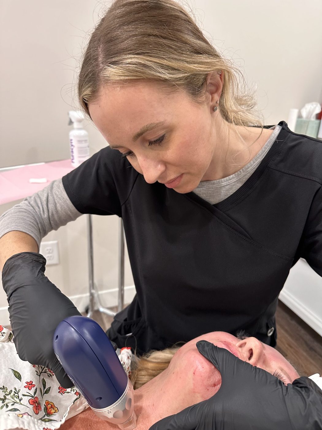 Microneedling with PRP, and who it suits