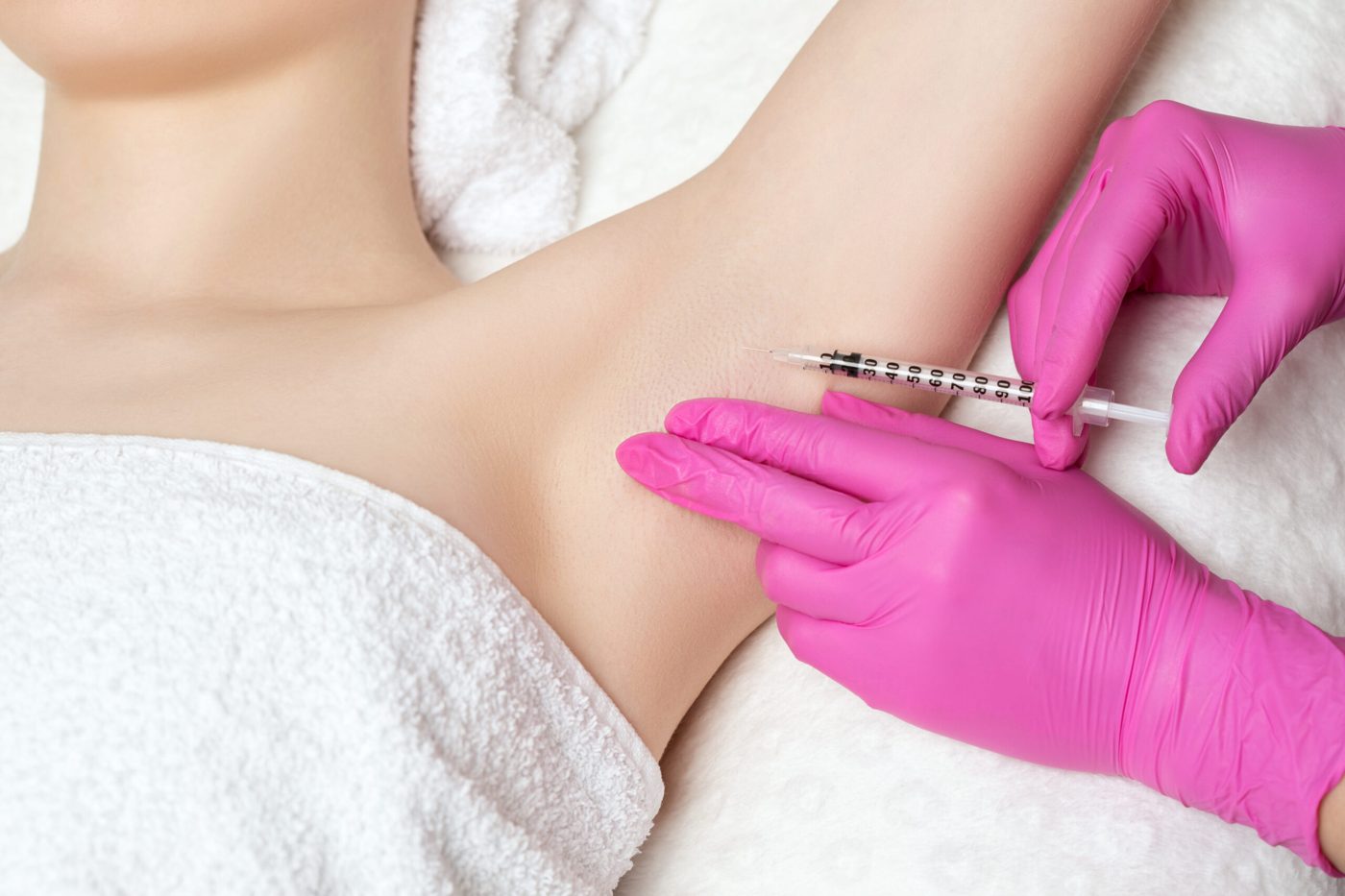 Underarm sweating treatment at Glacial Lakes Aesthetics in Spicer, Minnesota